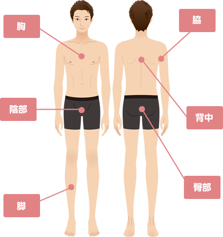 頭髪・顔以外の全身の無駄毛処理